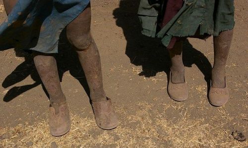 Zdjecie ETIOPIA / Pnocna - rodkowa Etiopia / Siemen Mountains / Dziwna ale prawdziwa perspektywa 