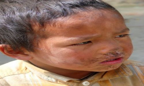 Zdjęcie NEPAL / brak / Lete / zagilone dziecie