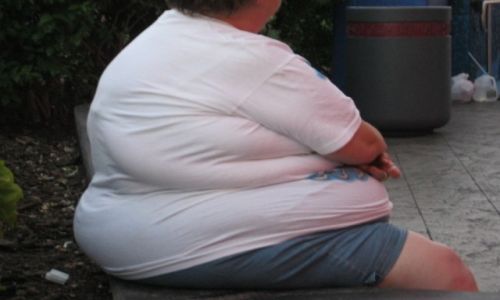 Zdjęcie USA / - / Stany Zjednoczone / Skutki jedzenia fast food-ów